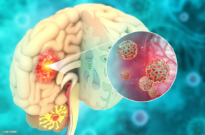 a diagram of a human brain with a red spot in the middle of the brain