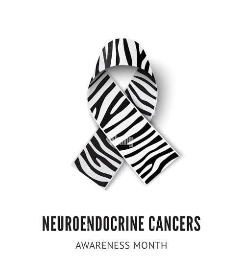 Understanding Neuroendocrine Tumors: Symptoms, Diagnosis, and Treatment Options