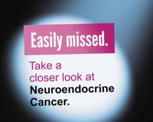 Raising awareness about neuroendocrine tumors (NETs)