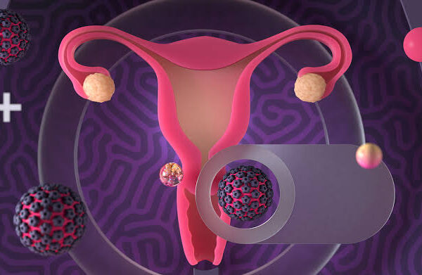 Learn about the potential link between frequent UTIs and cervical cancer. Discover how chronic infections may signal underlying health concerns and why early detection matters.