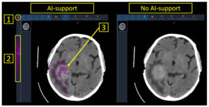 Radiology & AI: Transforming Cancer Imaging with Precision