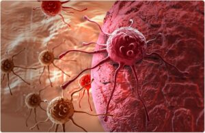Experience The Power of Early Cancer Detection: Better Outcomes & Less Risk