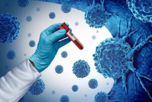 Early Cancer Detection Can Save Your Life